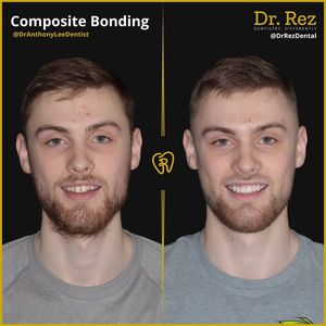 Image post by @drrezdental on Facebook