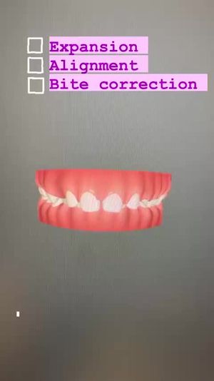 Video post by @weisstorortho on TikTok