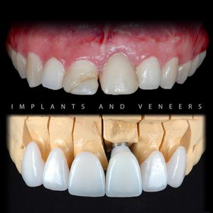 Image post by @sharpdentistry on Instagram