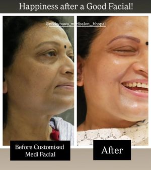 Image post by @nikkybawamedisalonbhopal on Instagram