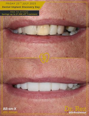 Image post by @drrezdental on Facebook