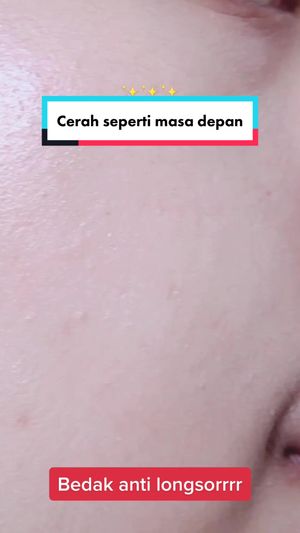 Video post by @lili.refliskin on TikTok