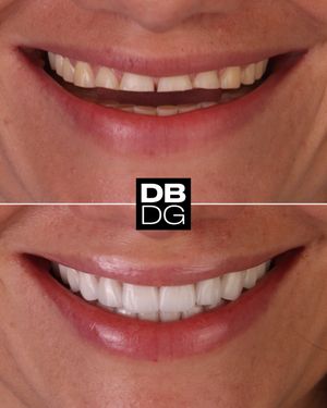Image post by @drdelfinbarquero on Instagram