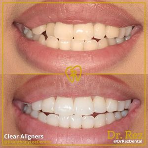 Image post by @drrezdental on Facebook