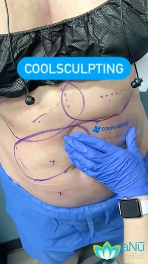 Video post by @anuaestheticsandwellness on Instagram