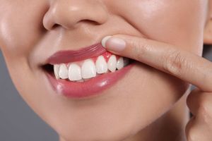 Image post by @nobscotdentalcare1 on Instagram