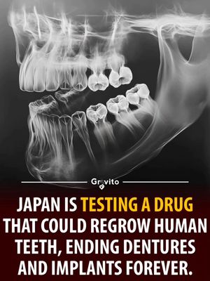 Image post by @gravitonomy on Instagram
