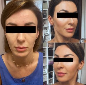 Image post by @dr.ralucaharnagea on Instagram