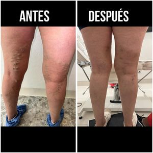 Image post by @dr.vicentevascular on Instagram