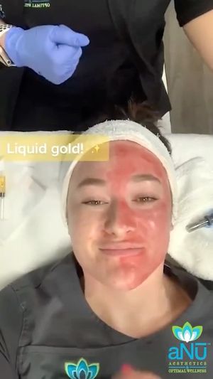 Video post by @anuaestheticsandwellness on Instagram