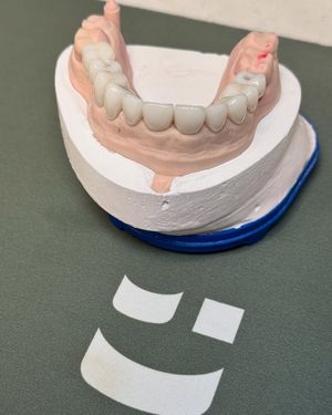 Image post by @fahaddentist on Instagram