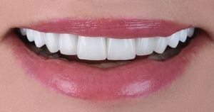 Image post by @sharpdentistry on Instagram