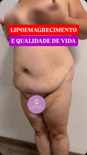 Video post by @drpresperd on Instagram