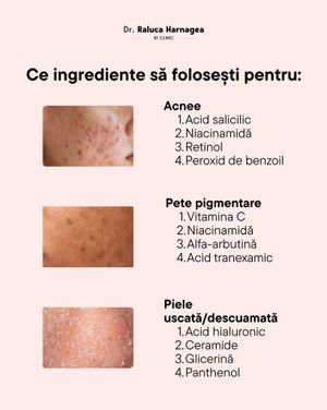 Image post by @dr.ralucaharnagea on Instagram