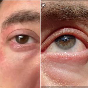 Image post by @irexlaser on Instagram