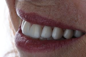 Image post by @sharpdentistry on Instagram