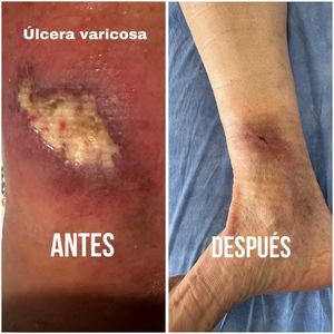 Image post by @dr.vicentevascular on Instagram
