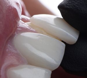Image post by @sharpdentistry on Instagram