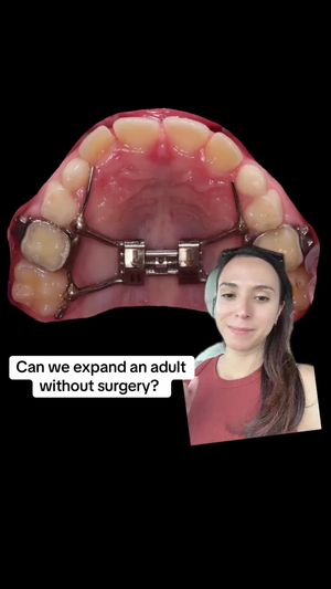 Video post by @weisstorortho on TikTok