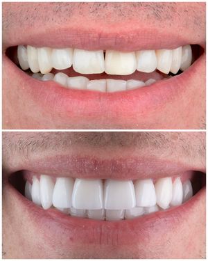 Image post by @sharpdentistry on Instagram