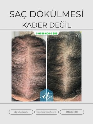 Image post by @drozlemteberik on Instagram