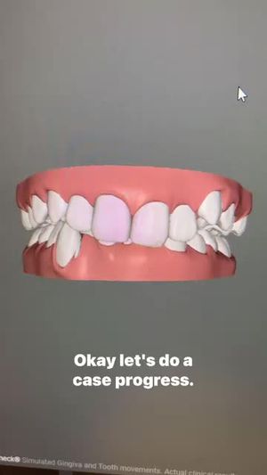 Video post by @weisstorortho on TikTok
