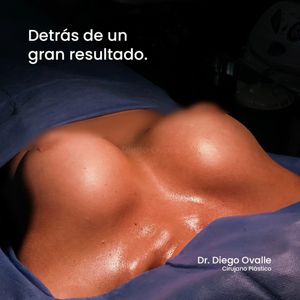 Image post by @dr.diegoovalle on Instagram