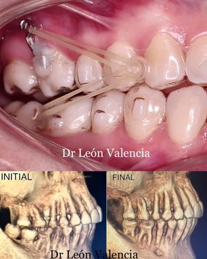 Image post by @dr.leon_valencia on Instagram