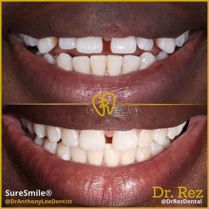 Image post by @drrezdental on Facebook