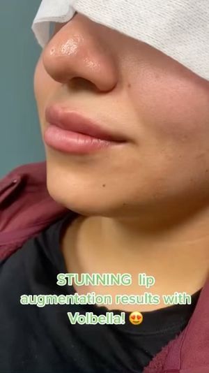 Video post by @anuaestheticsandwellness on Instagram