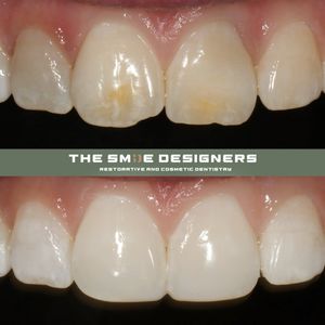 Image post by @fahaddentist on Instagram