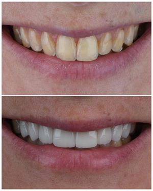 Image post by @sharpdentistry on Instagram