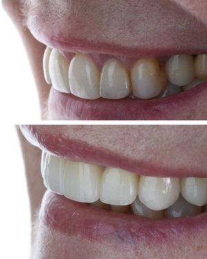 Image post by @sharpdentistry on Instagram