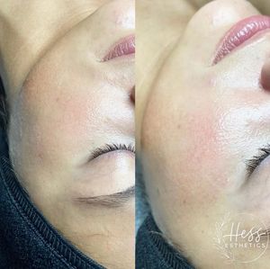 Image post by @HessBeautyBar on Facebook