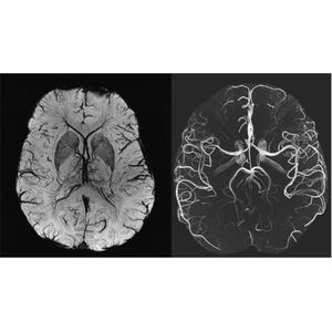 Image post by @imagecareradiology on Instagram