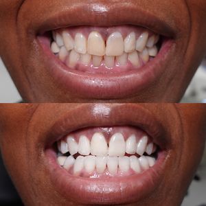 Image post by @islanddentalny on Instagram