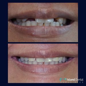 Image post by @islanddentalny on Instagram