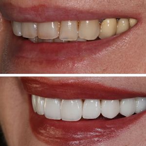 Image post by @islanddentalny on Instagram