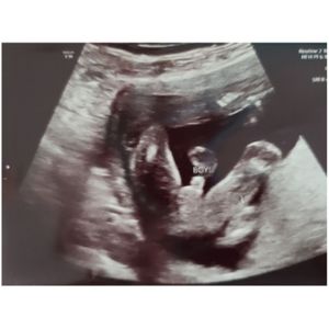 Image post by @imagecareradiology on Instagram