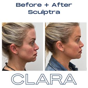 Image post by @clara.derm on Instagram