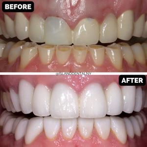 Image post by @islanddentalny on Instagram