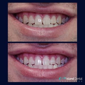 Image post by @islanddentalny on Instagram