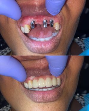Image post by @islanddentalny on Instagram