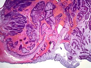 Image post by @vumcpathology on Instagram