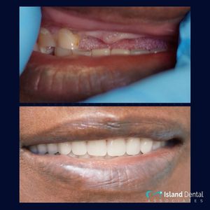 Image post by @islanddentalny on Instagram