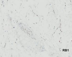 Image post by @vumcpathology on Instagram