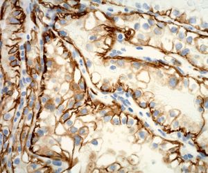 Image post by @vumcpathology on Instagram