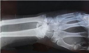 Image post by @imagecareradiology on Instagram