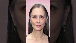 Video post by @ladyplasticsurgeon on YouTube