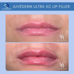 Image post by @currentmedspa on Instagram